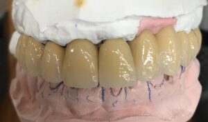 WhatsApp Image 2025-03-26 at 10.41.51_786f8e2f