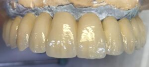 WhatsApp Image 2025-03-26 at 10.45.35_df76370d