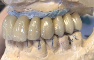 WhatsApp Image 2025-03-26 at 10.46.18_d2045606