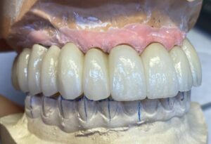 WhatsApp Image 2025-03-26 at 10.52.58_bafdd57f